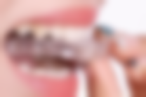 补牙拔牙医保报销吗？各地政策有差异，成都、柳州等情况不同，大学生报销也有规定！ 