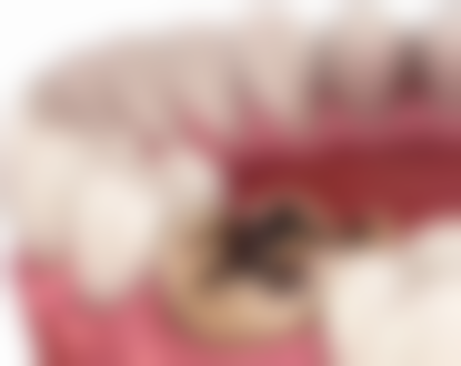 牙齿矫正和保持器一共需要多少时间？一般1 - 3年，受年龄、错位程度等多因素影响！ 