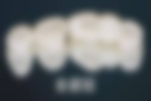 姨妈前5天拔牙的特殊情况