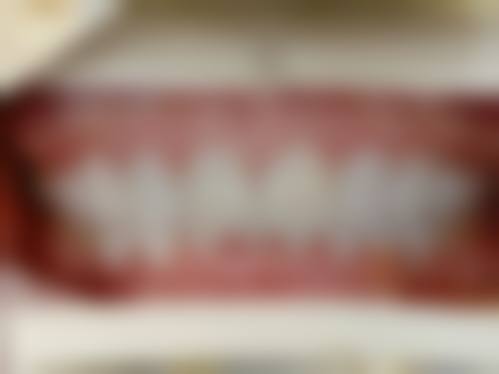 四、江苏淮安牙管家口腔特色项目