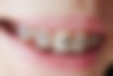 四、商丘爱齿口腔医院特色项目