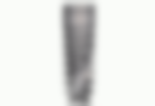 牙根健康状况决定是否拔除