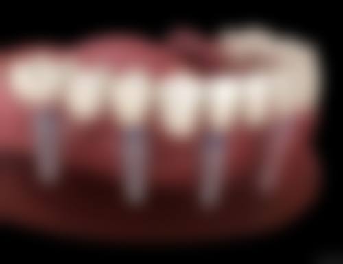 五、上海王德康口腔诊所收费价格表