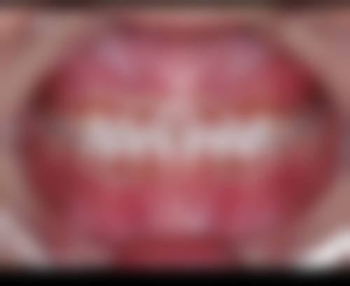 四、鹤壁淇水口腔门诊部特色项目