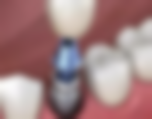 四、东莞谢岗同进口腔特色项目