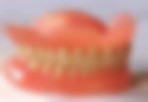 不做根管治疗能补牙吗？这得看牙齿具体情况，部分情况可直接补，有的则必须根管治疗！ 