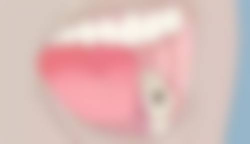 四、内江唐人口腔诊所特色项目