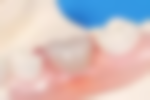 八、太原泰康拜博口腔中海门诊部怎么预约?