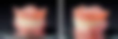 六、唐山微尔特英伦口腔隋广英医生口碑评价及真人实例反馈