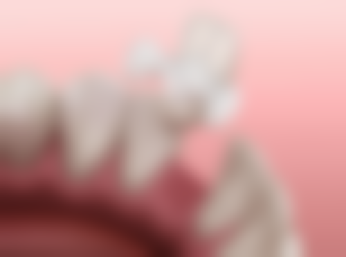 根管治疗后刷牙的正确方法和力度要求