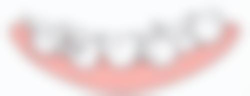 全瓷牙对人体有危害吗？正常情况无危害且有优势，但可能存在并发症和其他风险！ 