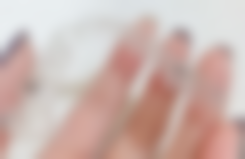 活动活动义齿的优劣势