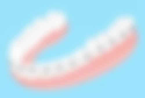 根管治疗后下一步是做什么？一般是补牙或做牙套，1 - 2周无症状便可进行牙冠修复！ 