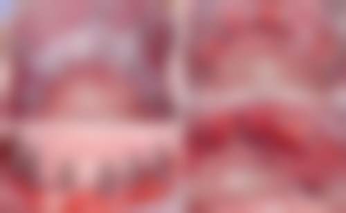 五、杭州口腔医院滨江门诊部收费价格表