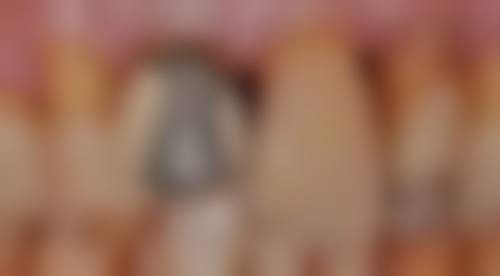 四、重庆鹏博口腔(彭水分院)特色项目