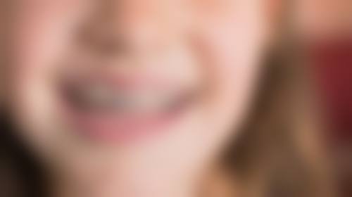 六、黄石春天口腔孙楚春医生口碑评价及真人实例反馈