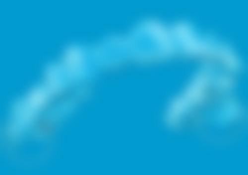 成年人牙齿矫正的成功实例