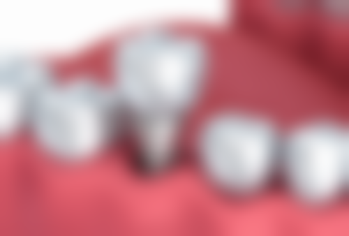 八、长沙宁乡市齿邦口腔(翠湖院店)怎么预约？