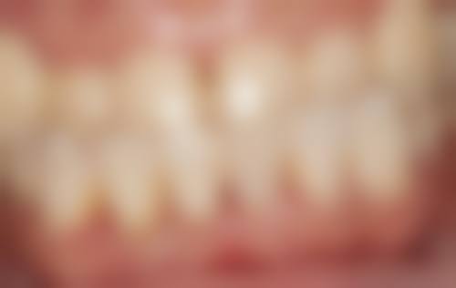 六、浙江台州三门吴能旺口腔诊所口碑如何?