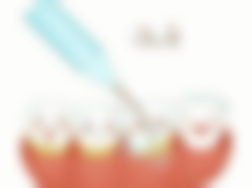 牙齿能摇动需要拔牙吗？松动程度、病因等多因素决定，专业医生评估后才好定方案！ 