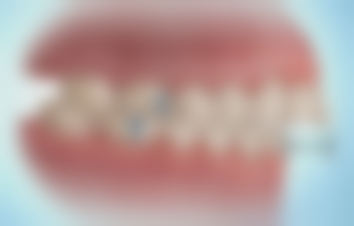 二、烟台雅康口腔王小红医生擅长项目