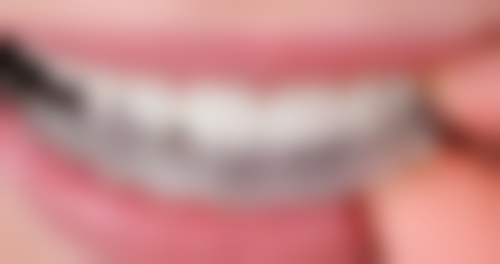 五、北京孙波李健军 医生技术怎么样?