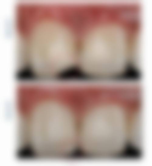 八、杭州艾维西溪路口腔门诊部怎么预约？