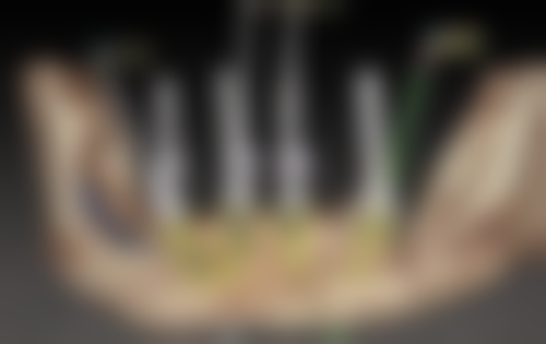 四、江门蓬江庄晓明口腔诊所特色项目