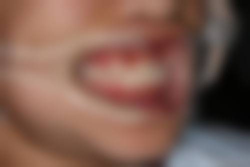 八、邯郸市希恩齿科口腔门诊部怎么预约？