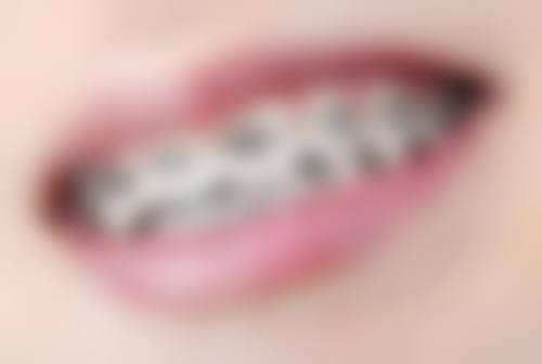 二、上海丽洁口腔陈嘉珮医生擅长项目