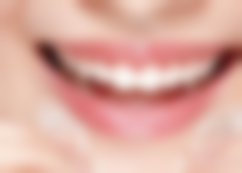 专精牙医常用的去除方法