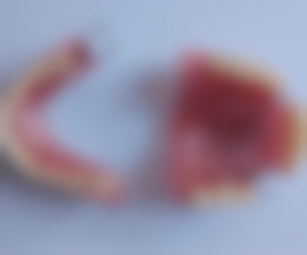 四、成都华医口腔特色项目