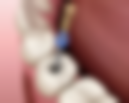 六、上海丽洁口腔陈嘉珮医生口碑评价及真人实例反馈