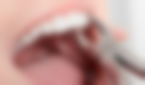 五、同济大学附属口腔医院口腔综合科收费价格表