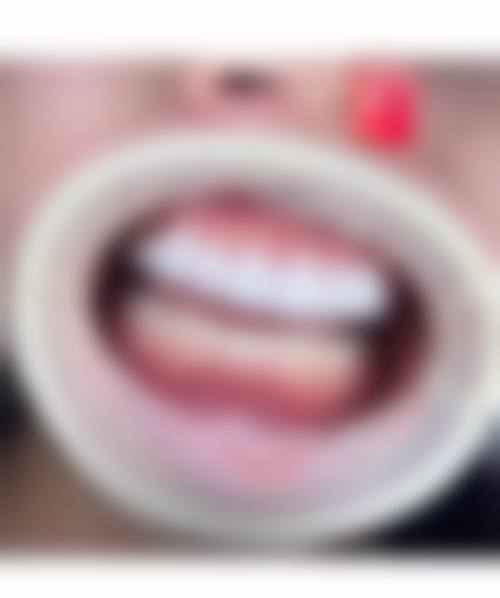 三、景德镇昌华玉牙口腔(泰豪店)医生介绍