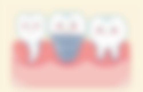 八、杭州美莱口腔医院怎么预约？