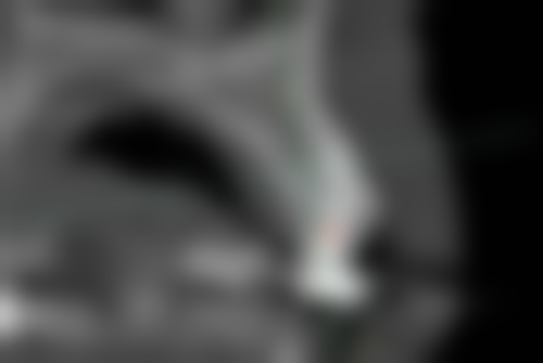 五、济南历下爱康口腔诊所收费价格表