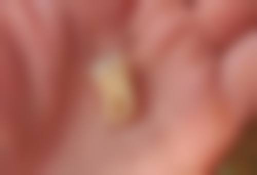 五、蚌埠三爱口腔万海峰医生技术怎么样？