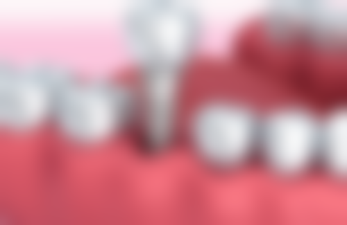 四、山东济南齿客口腔特色项目