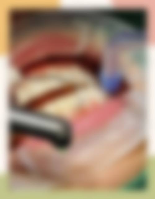 八、温州瑞安韩慧口腔怎么预约?