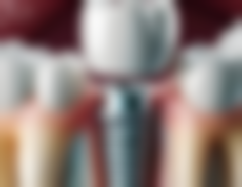 自己拔牙的出血风险