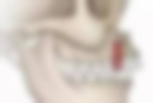 发烧能拔牙吗 智齿？多位医生建议发烧时慎拔，特殊情况除外，看完你就懂了！ 