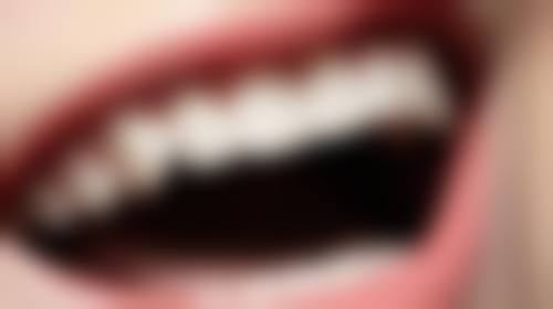 四、渭南临渭贝壳口腔门诊部特色项目