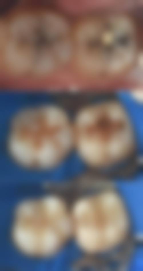 五、银川佳成口腔诊所收费价格表