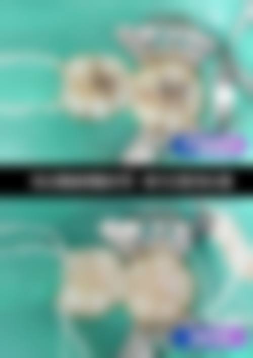 五、南昌红谷滩贝文口腔诊所收费价格表