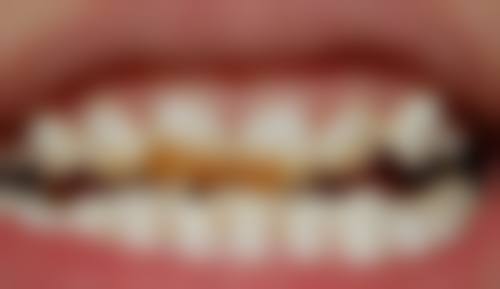 综合评估：多方面考量确保安心有效