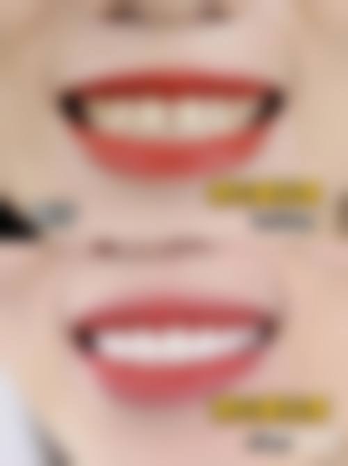 六、浠水县领航先峰口腔门诊部口碑如何？