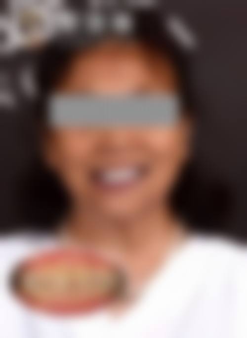 五、浠水县领航先峰口腔门诊部收费价格表