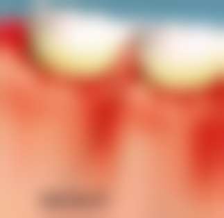 全身健康限制：多种疾病影响手术决策