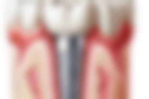 四、岳阳湘阴卓越口腔特色项目